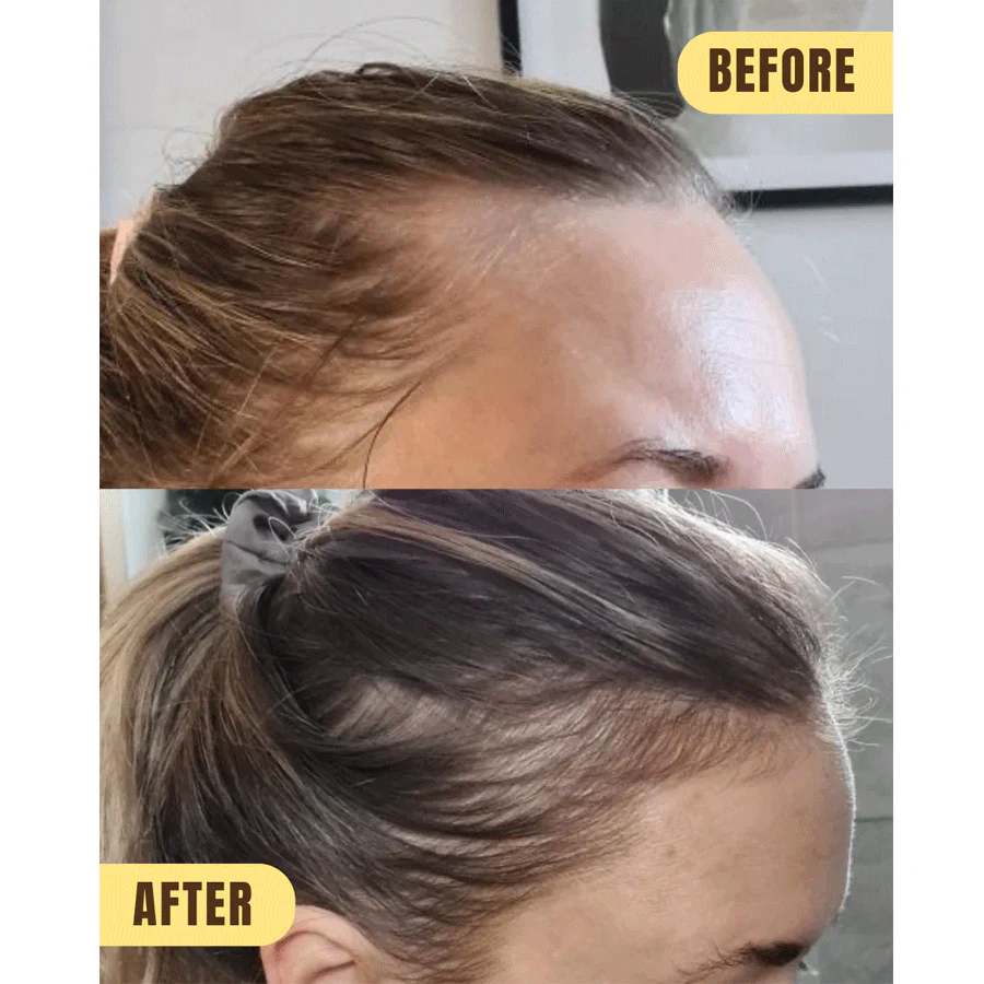 Hair Syrup Grows-Mary Scalp Activating Pre-Wash Oil Treatment 100ml - Image 2