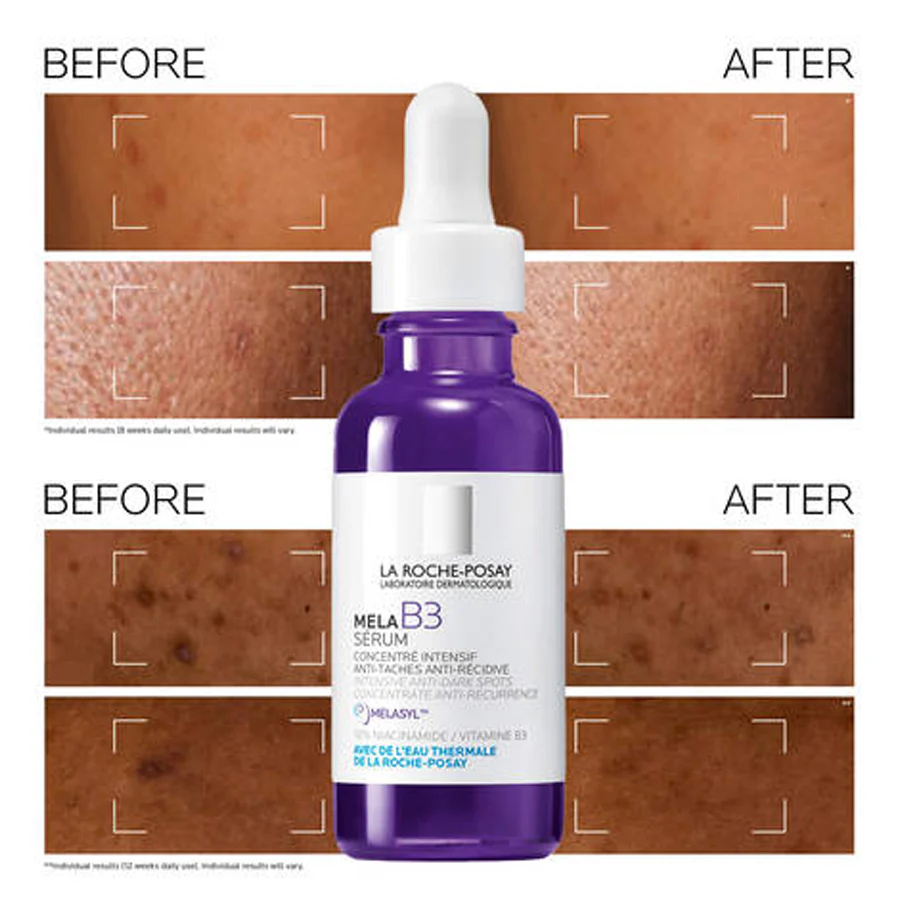 La Roche-Posay Mela B3 Intense Anti-Dark Spot Serum 30ml - Image 2